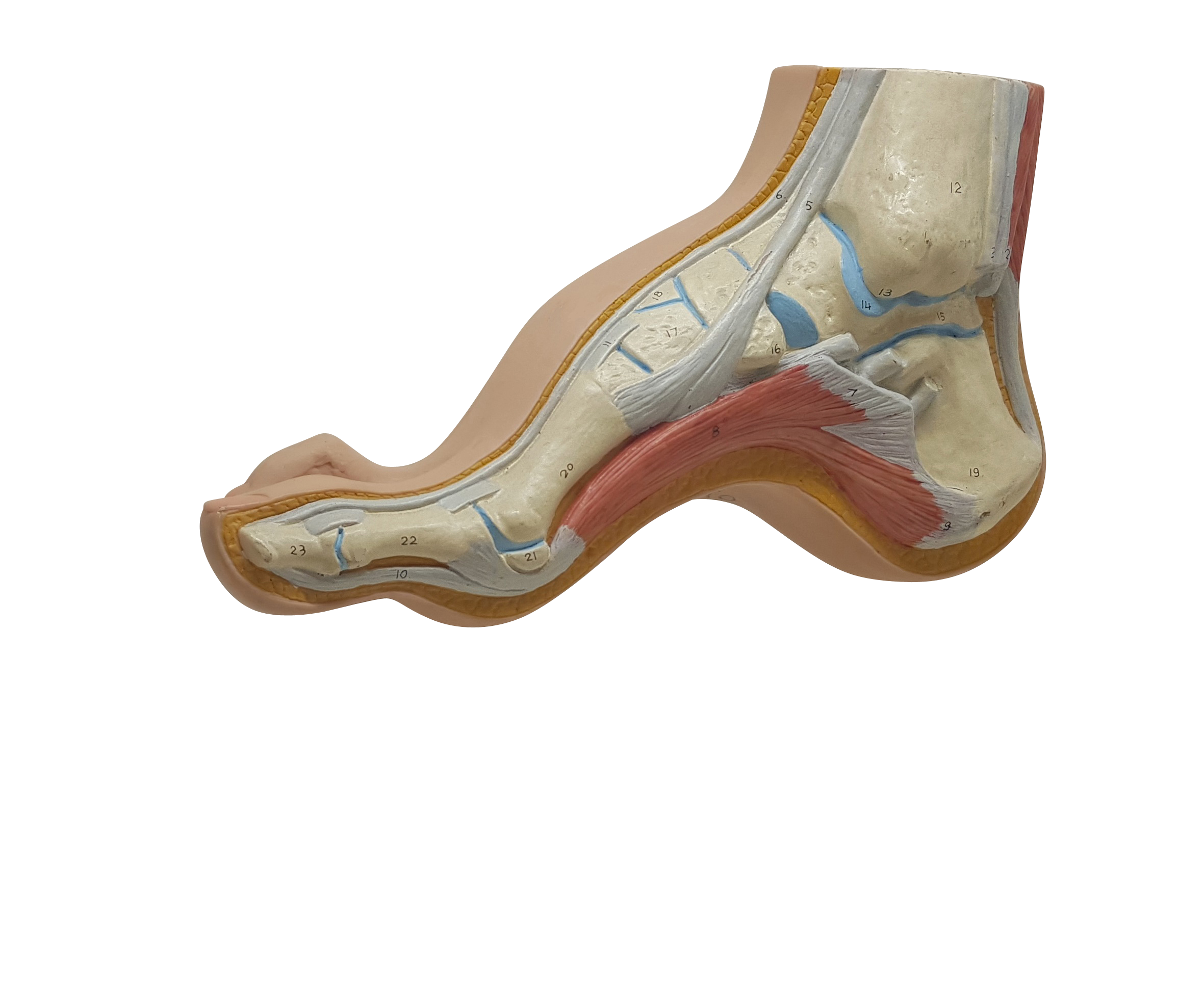 요족, High-Arch Foot
