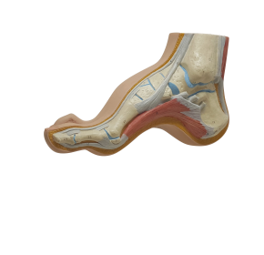 요족, High-Arch Foot