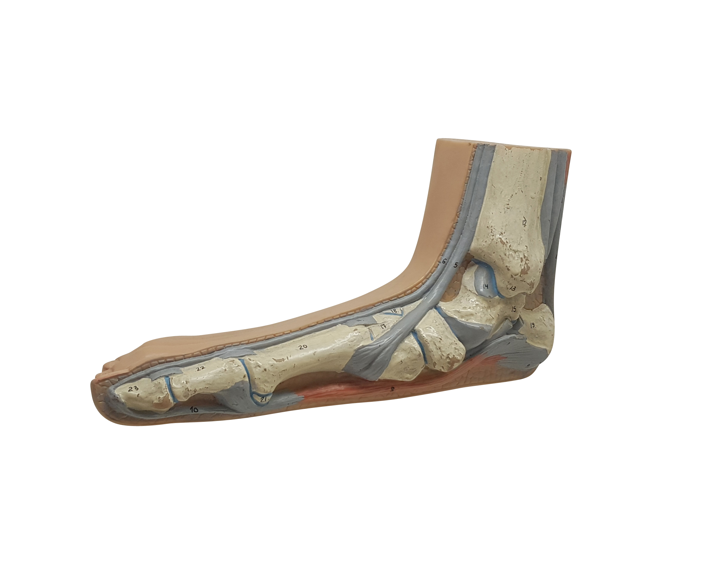 평발, Flat Foot