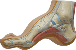 요족, High-Arch Foot