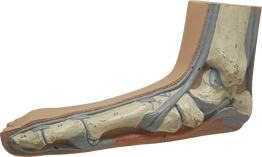 평발, Flat Foot